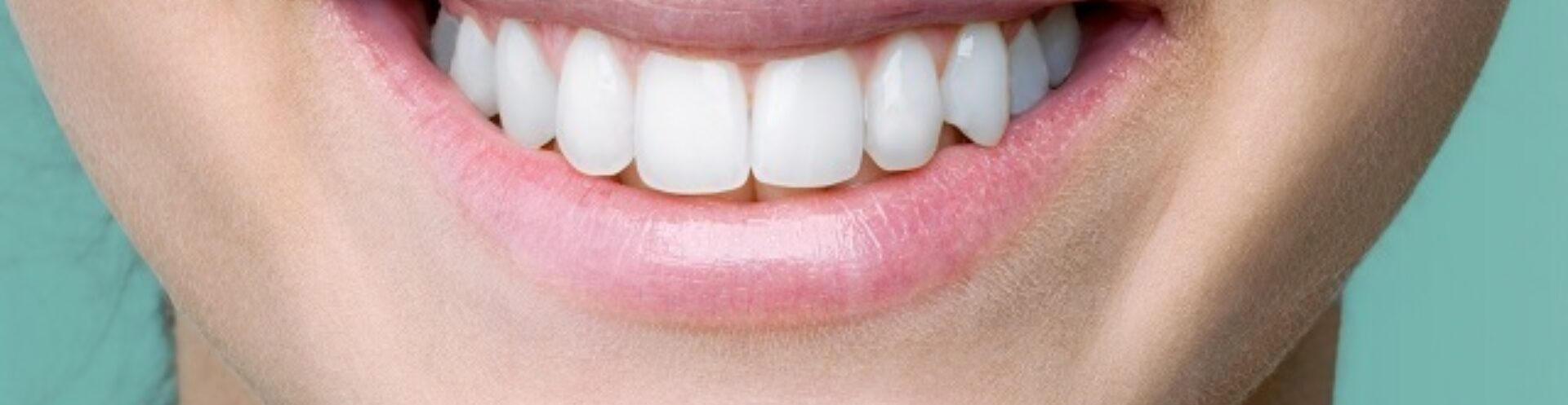 Dental bonding home page