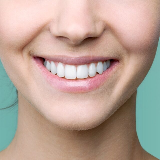 Dental bonding home page