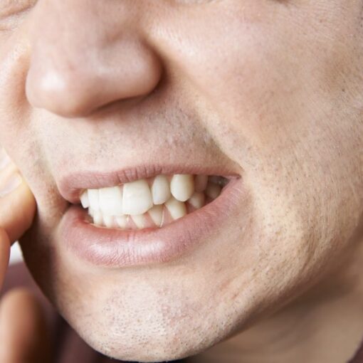 Bowie MD Dentist Jaw Clenching 1024x684
