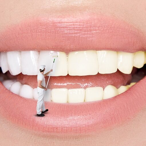 Dental hygieinist airflow